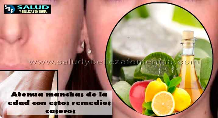 Atenua manchas de la edad con estos remedios caseros Atenua manchas de la edad con estos remedios caseros