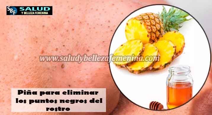 Piña para eliminar los puntos negros del rostro