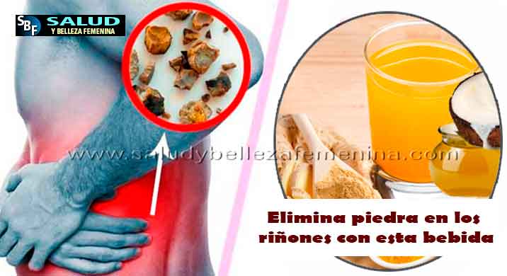 Elimina piedra en los riñones con esta bebida poderosa Elimina piedra en los riñones con esta bebida poderosa