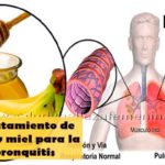 Eficaz-tratamiento-de-platano-y-miel-para-la-tos-y-bronquitis