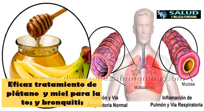 Eficaz tratamiento de plátano y miel para la tos y bronquitis