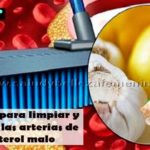 Remedio-para-limpiar-y-destapar-las-arterias-de-colesterol-malo