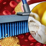 Remedio para limpiar y destapar las arterias de colesterol malo