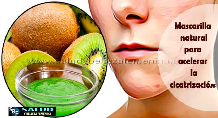 Mascarilla natural muy potente para acelerar la cicatrización Mascarilla natural muy potente para acelerar la cicatrización