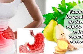 Combate la gastritis de forma rápida con estos remedios caseros