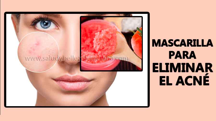 Mascarilla para eliminar el acné