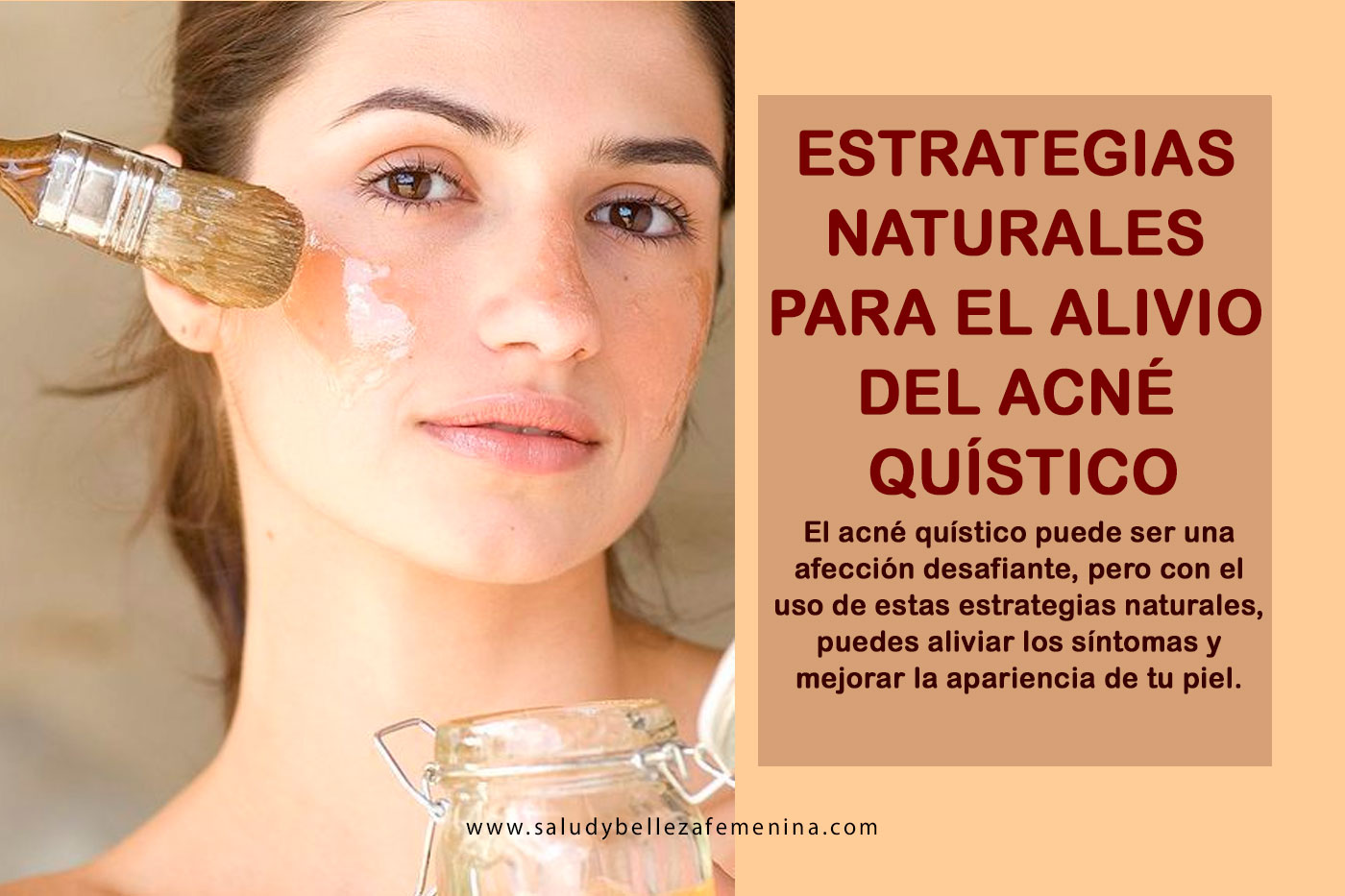 Joven aplicando tratamiento natural para el alivio del acné quístico en su rostro